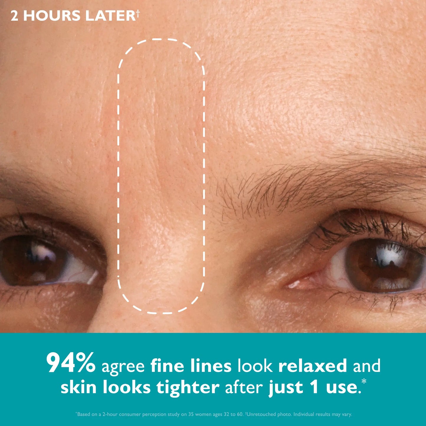 Peter Thomas Roth Peptide Skinjection Peptide Infused Face + Eye Tape, Improve Look of Fine Lines and Wrinkles
